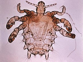 290px-Pthirus_pubis_-_crab_louse.jpg